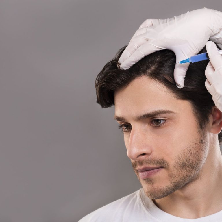 Benefits-of-PRP-hair-treatment