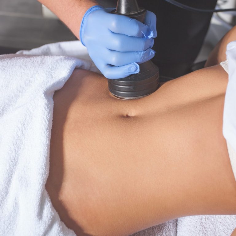 Body-contouring