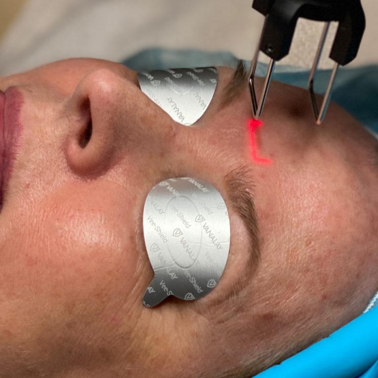 CoolPeel-2