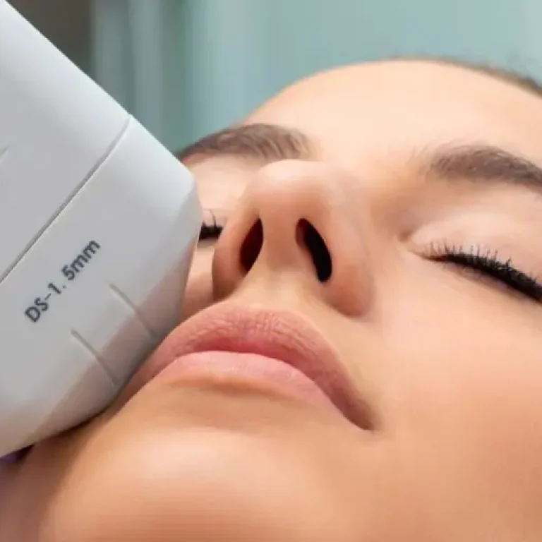hifu-facial-768x512