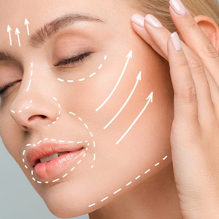 lifting-facial2