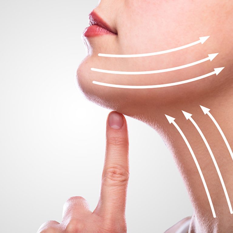 non-invasive-neck-lift