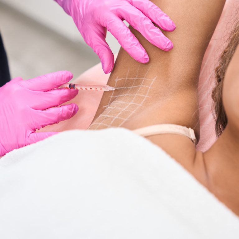 Young female patient with a problem of hyperhidrosis receives botulinum toxin injections in the armpit area in a cosmetology clinic